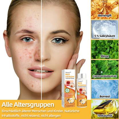 Turonu™ Bienengift-Therapiespray (EMA-Zertifizierung)