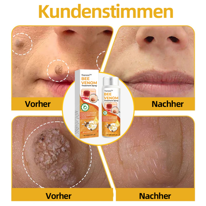 Turonu™ Bienengift-Therapiespray (EMA-Zertifizierung)