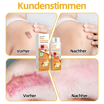 Turonu™ Bienengift-Therapiespray (EMA-Zertifizierung)