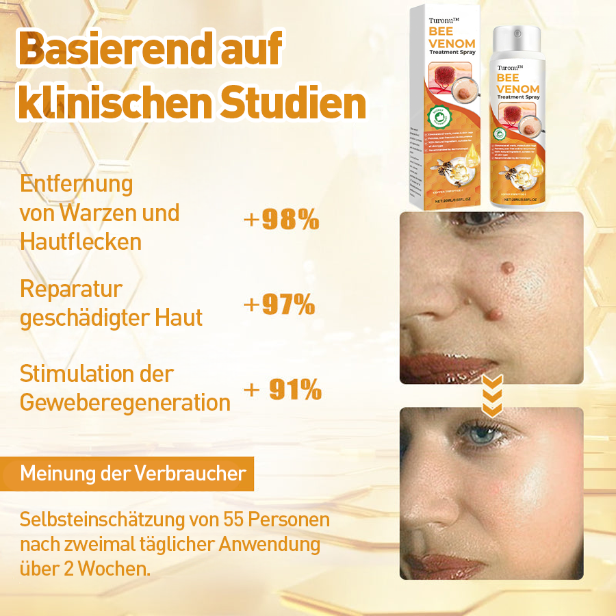 Turonu™ Bienengift-Therapiespray (EMA-Zertifizierung)